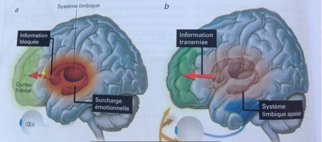 explication de l'effet de la thérapie emdr sur le cerveau une fois la mémoire traumatique retraitée